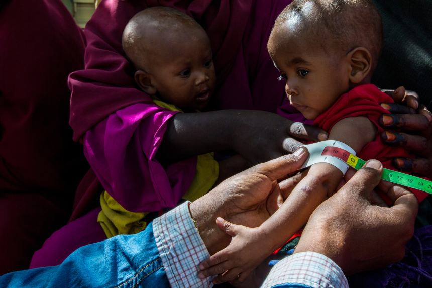 A young child measured for malnourishment in Somalia. Photo by USAID_IMAGES, CC BY-NC 2.0.